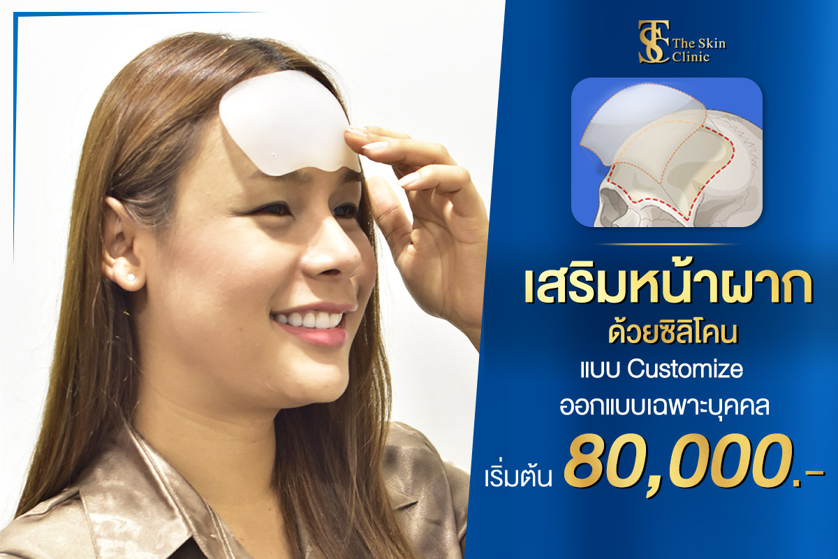Promotion เสริมซิลิโคน ปรับรูปหน้า